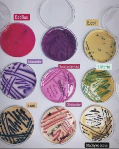 Microbiología con salmonella